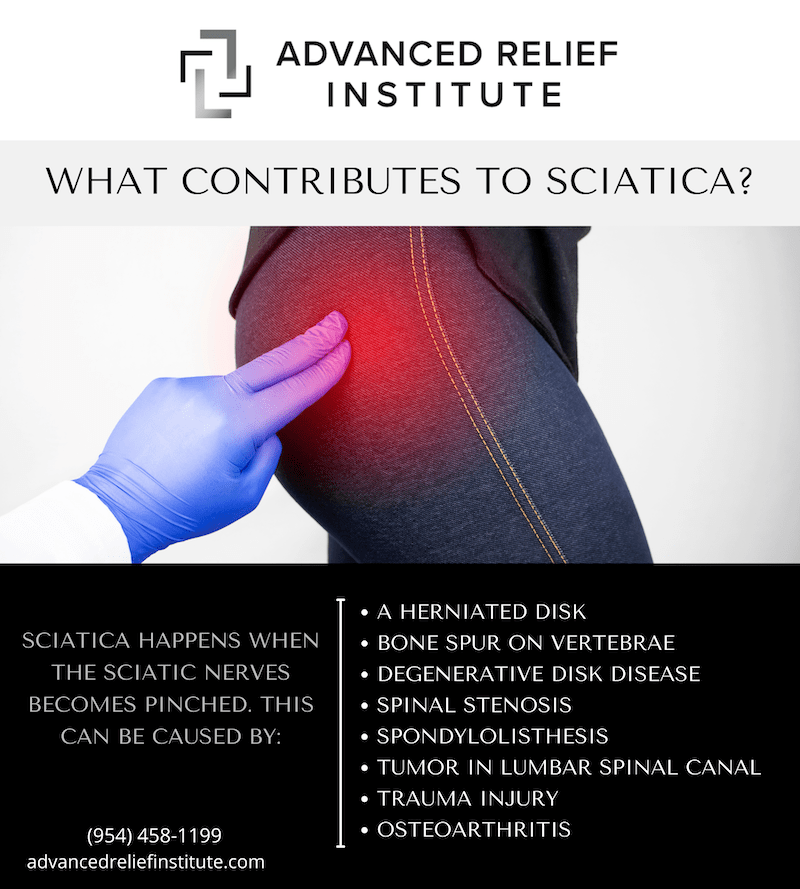 Infographic showing causes of sciatica.